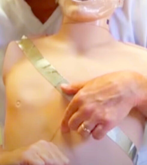 Manovra di Heimlich